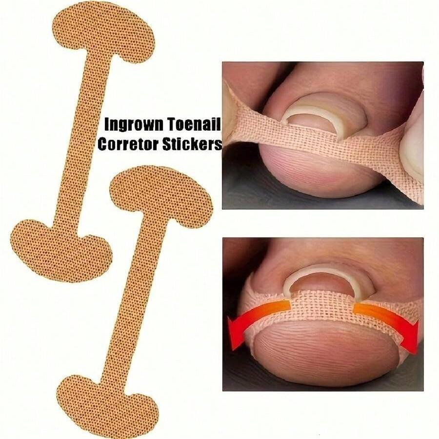 

Наклейка для коррекции вросшего ногтя, клейкий пластырь для ногтя, эластичное средство для лечения ногтей, наклейка-корректор, инструменты для ухода за ногами