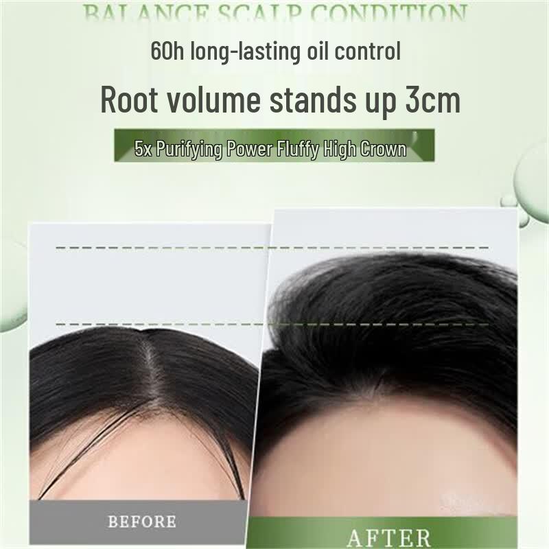 Seeyoung Soapberry Anti-Dandruff Oil Control Volumizing Shampoo