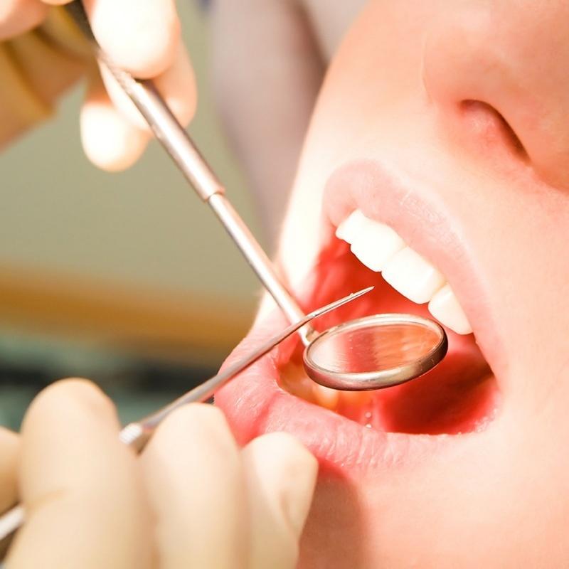 Dental Mirror Stomatological Examination Mirror Dentist Materials Blackhead Removal Tool Dental Laboratory Equipment