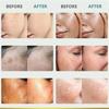 Whiten Cream Brighten Face Effective Remove Melasma Dark Spot Improve Dullness Skin Anti-pigmentation Care Cream Care Products