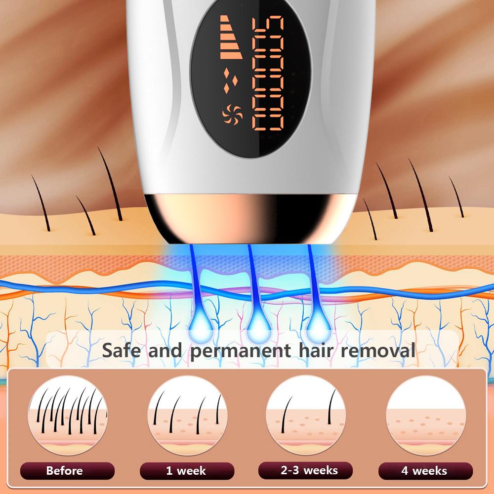 HOMZY Portable IPL Laser Epilator 999999 Flashes - Painless, Permanent Hair Removal for Women’s Body and Bikini Line