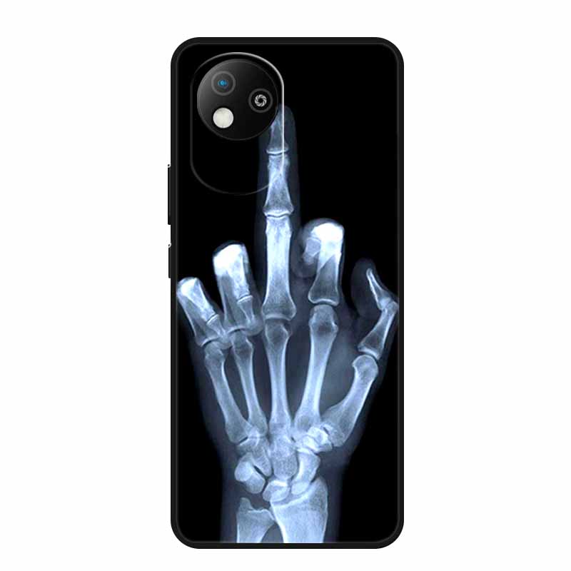 For ZTE BLADE A35 Lite Case Animals Soft Silicone TPU Phone Cases Back Cover for ZTE BLADE A35Lite Shockproof Protector New Capa