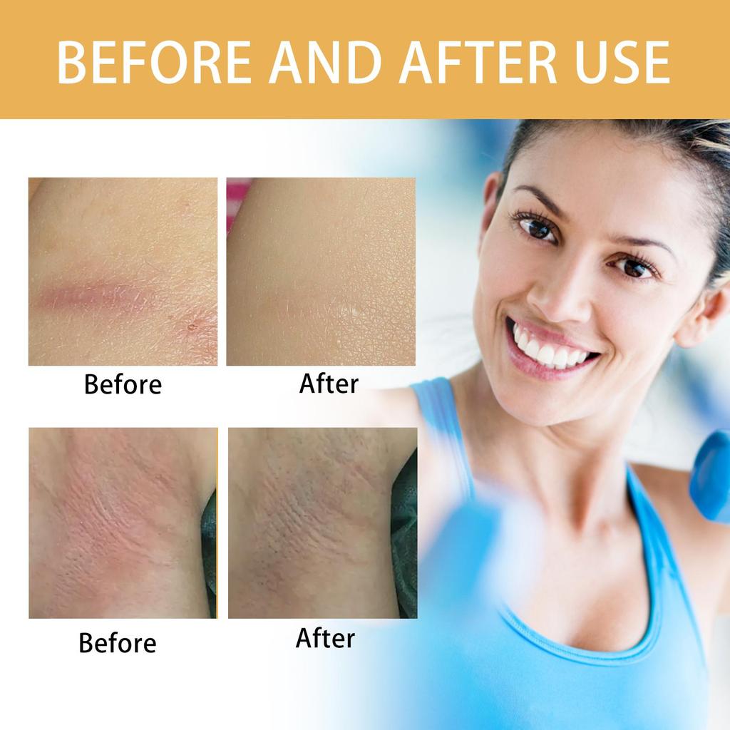 OUHOE Körperpflegestift Hautschonend feuchtigkeitsspendend feuchtigkeitsspendend gegen Trockenheit Risse verhindern Reibung Körpergelenkpflege