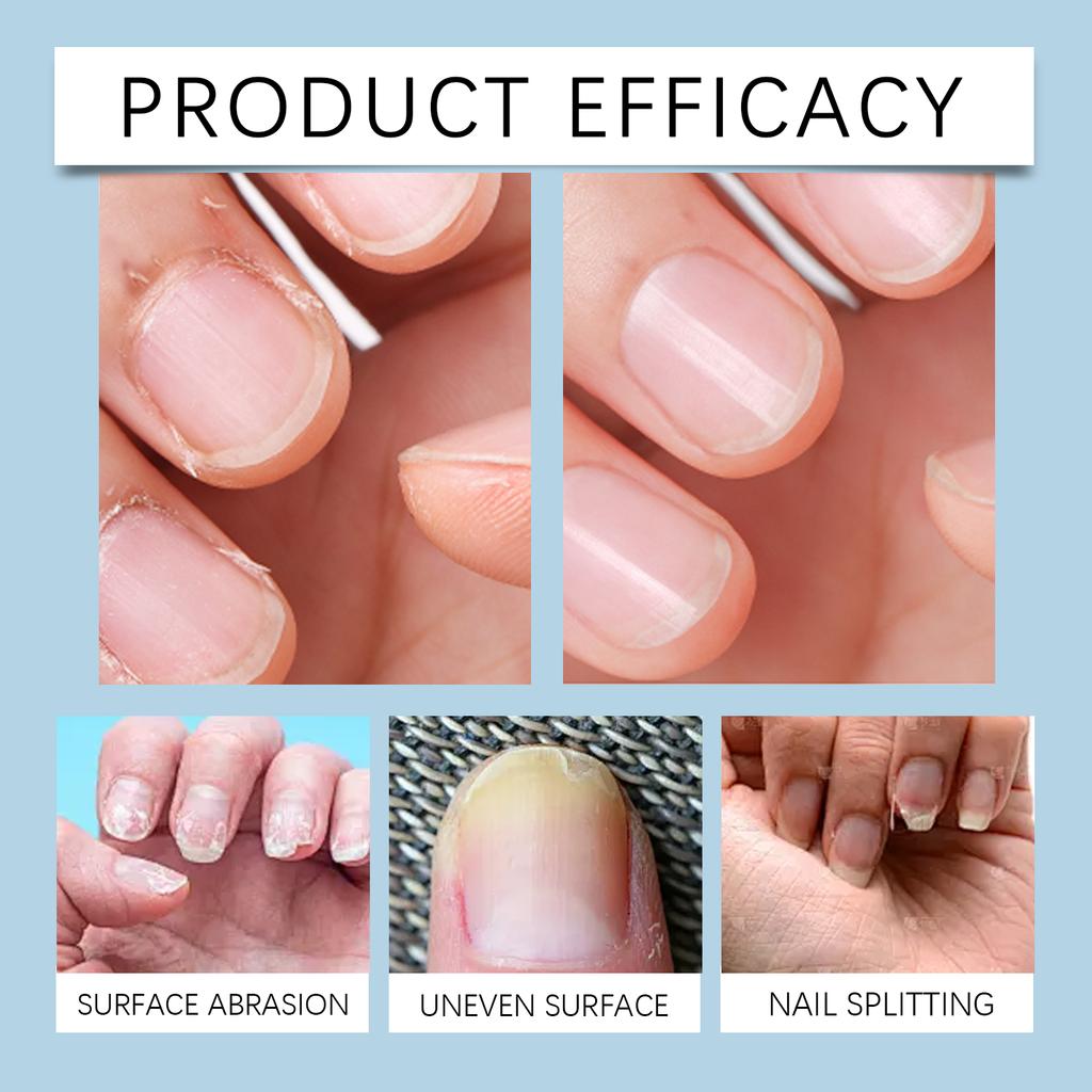 Automatiska nagelklippare, Nageltrimmer, Bärbara nagelfilar som inte skadar händerna