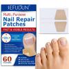 Ingrown Toenail Sticker Corrector Patches Big Toe Nail Corrector Renewal Plaster