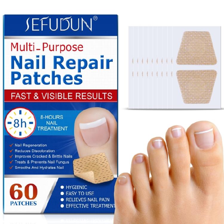 Ingrown Toenail Sticker Corrector Patches Big Toe Nail Corrector Renewal Plaster