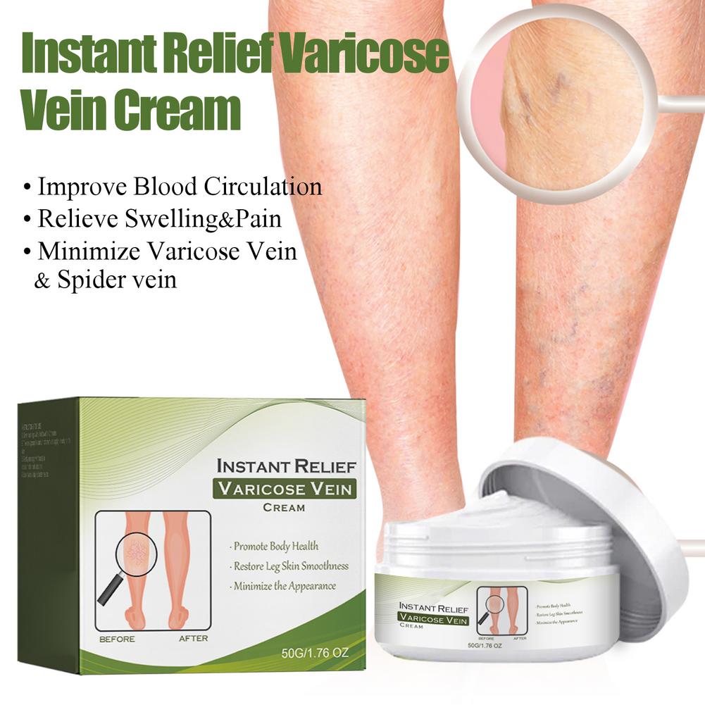 50g Varicose Vein Repair Cream Tongmai Effective Relieves Leg Bulge Pain Treatment Cream Vasculitis Phlebitis Vein Repair Cream