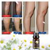 OUHOE Chamomile Essential Oil for Varicose Veins 10ml