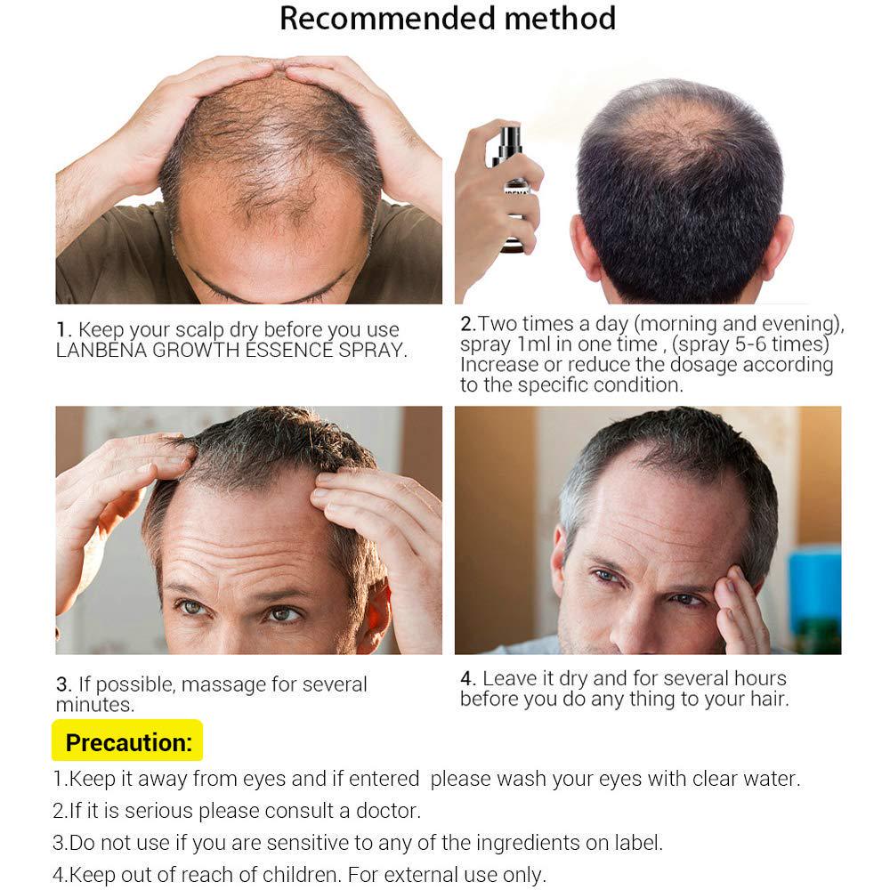 Spray de Esencia para el Crecimiento del Cabello Para Prevenir la