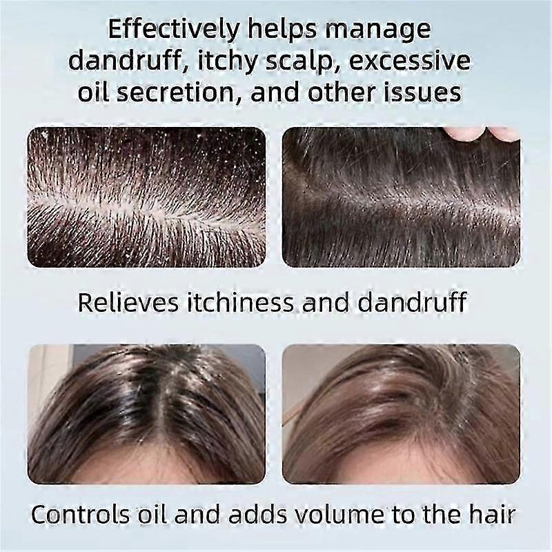 Selenium Disulfide Anti Dandruff Shampoo Helps Control Oil and Reduce Dandruff, Gentle Cleansing Shampoo for Dandruff, Dry & Oily Hair, Fresh, Soothin