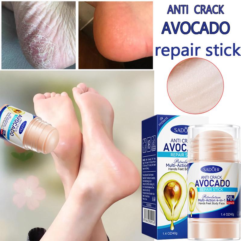 60% Urea Foot Cream Aloe Vera Ultra-hydrating Softening Dry Cracked Feet Cream Gentle Exfoliation Daily Foot Care Solution 40g