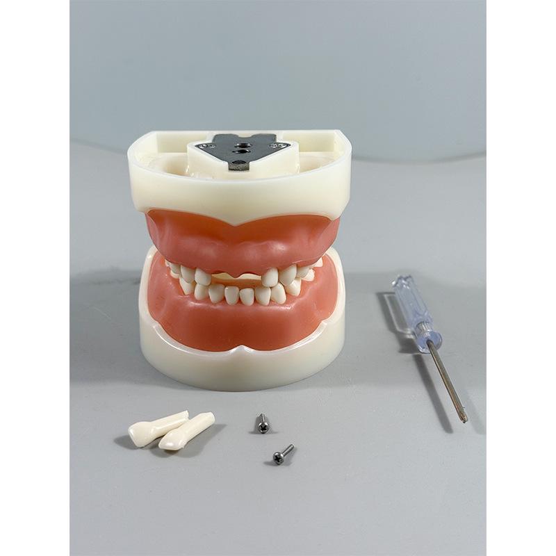 Прозора Знімна Повна Модель Щелепи з М'якими Яснами та Зубами для Підготовки до Імплантації