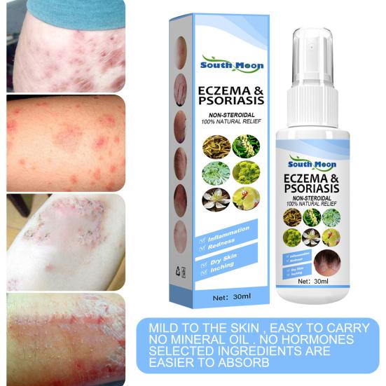 30ml Eczema Essence Non-Pungent Anti-Itch Herbal Extract Skin Salve Eczema Treatment Non Greasy Spray for Adult