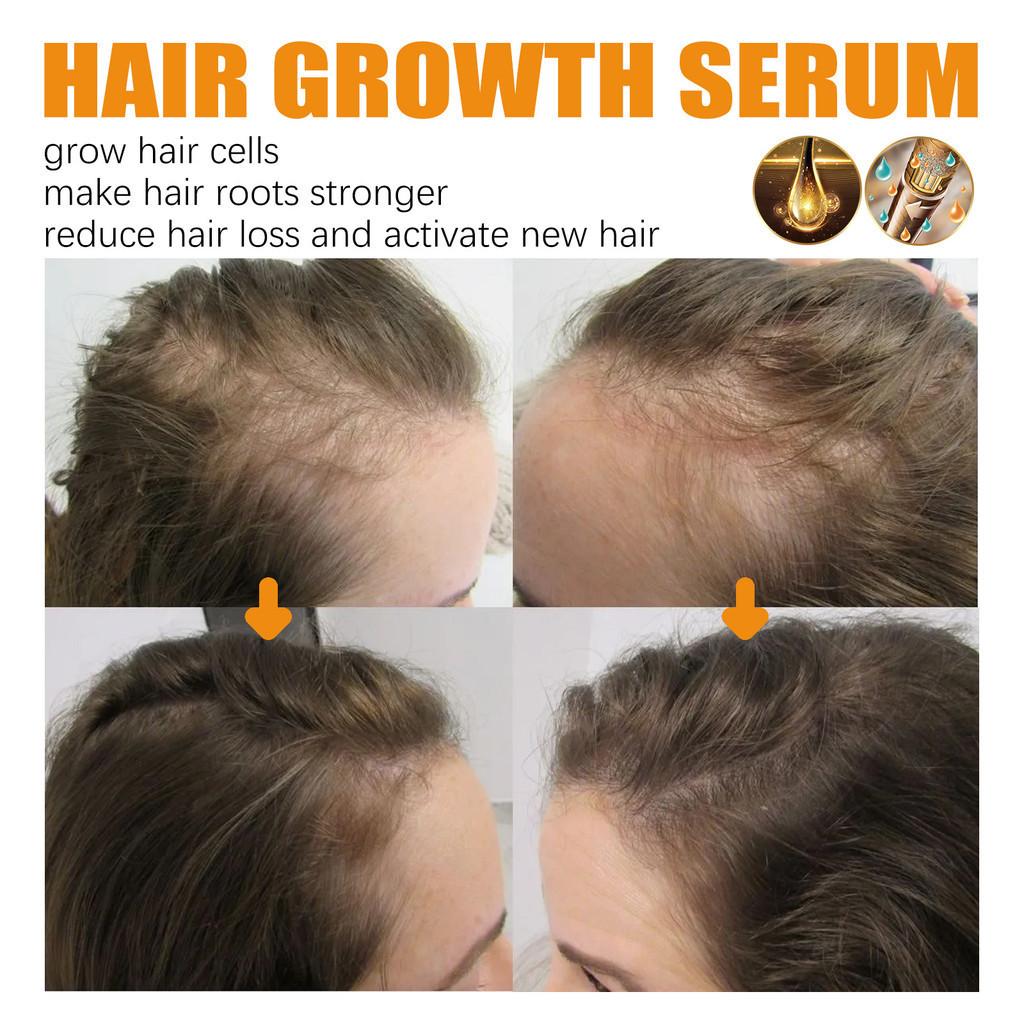 West Month Hair Growth Nutrient Oil For Lush And Thick Hair Nourishing Care 30ml