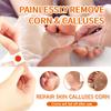 10/20/30/50Pcs Mesh Round Corn Remover Pads Foot Corn-Callus Plaster With Hole Corn Cushions Patches Shoe Foot Care Products