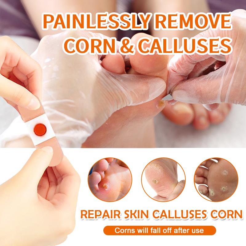 10/20/30/50Pcs Mesh Round Corn Remover Pads Foot Corn-Callus Plaster With Hole Corn Cushions Patches Shoe Foot Care Products