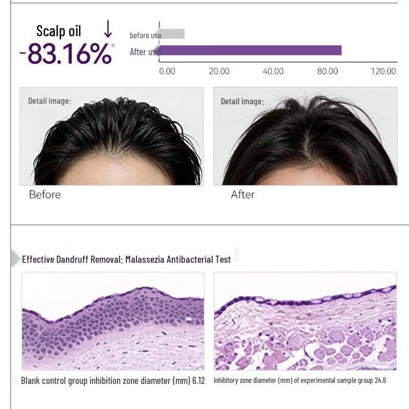 Longfa Xiaozhai Rice Water Anti-Dandruff Shampoo