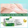 Hoygi Gentle Body Acne Cream Nourishing Moisturizing Treatment For Smooth Skin