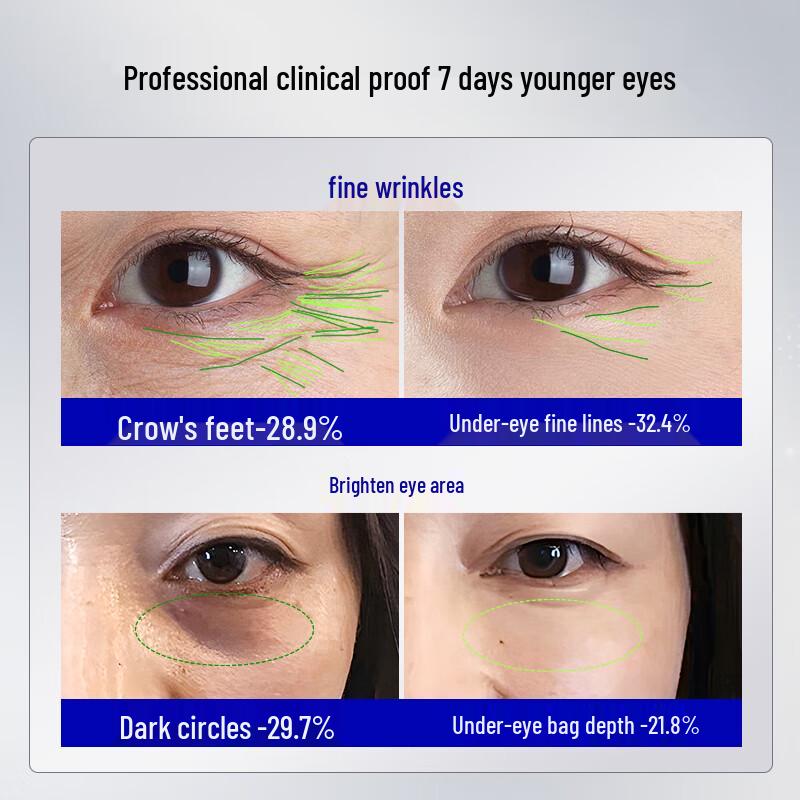 HURMEVKOR Collagen Peptide Eye Cream for Fine Lines & Dark Circles