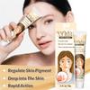 Vitiligo Cream, Natural Vitiligo Ease For Skin Vitiligo, Vitiligo Care Cream, Reduce Spots And Improve Skin Pigmentation, Easy To Use