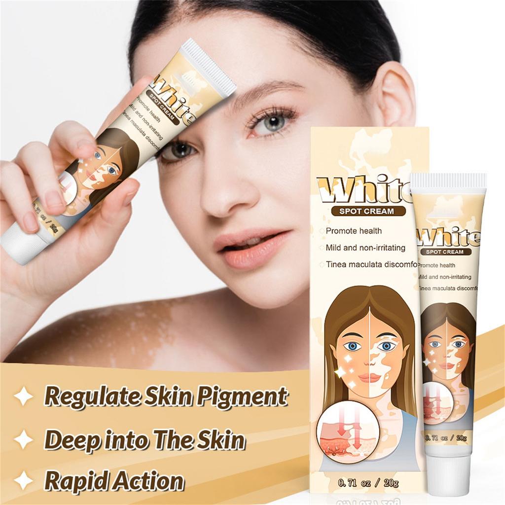 Vitiligo Cream, Natural Vitiligo Ease For Skin Vitiligo, Vitiligo Care Cream, Reduce Spots And Improve Skin Pigmentation, Easy To Use