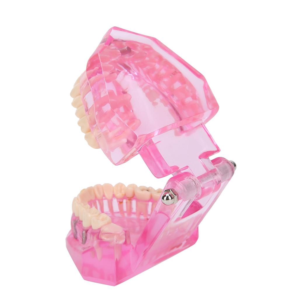 Transparent Adult Teeth Model Pathological Repair Studying Dental Teaching Tools