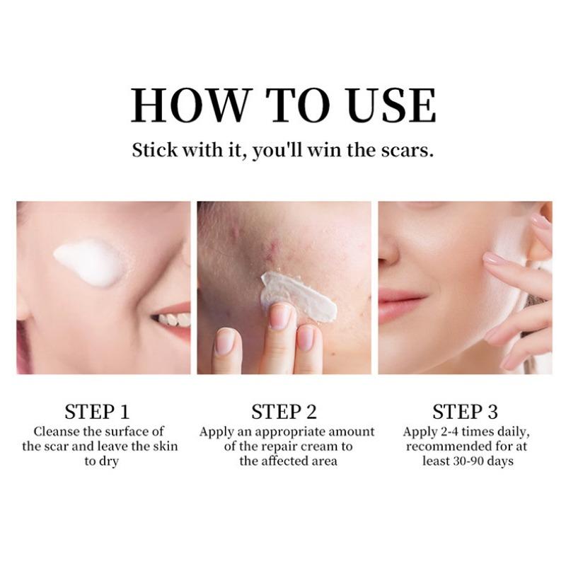 1PC After Burn Fading Skin Ointment