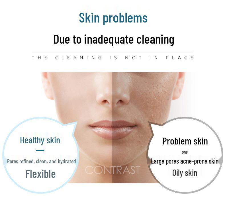 Facial Hydration & Pore Cleansing Device: Blackhead Removal & Oxygen Infusion