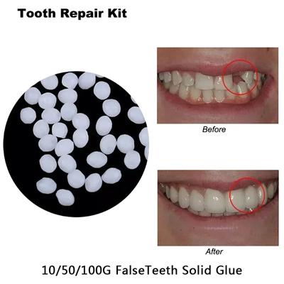 5-50ml Resin Tooth Repair Glue Shapeable Teeth Gaps Filling Solid Temporary Teeth Repair Falseteeth Glue Safety Dental Supplies