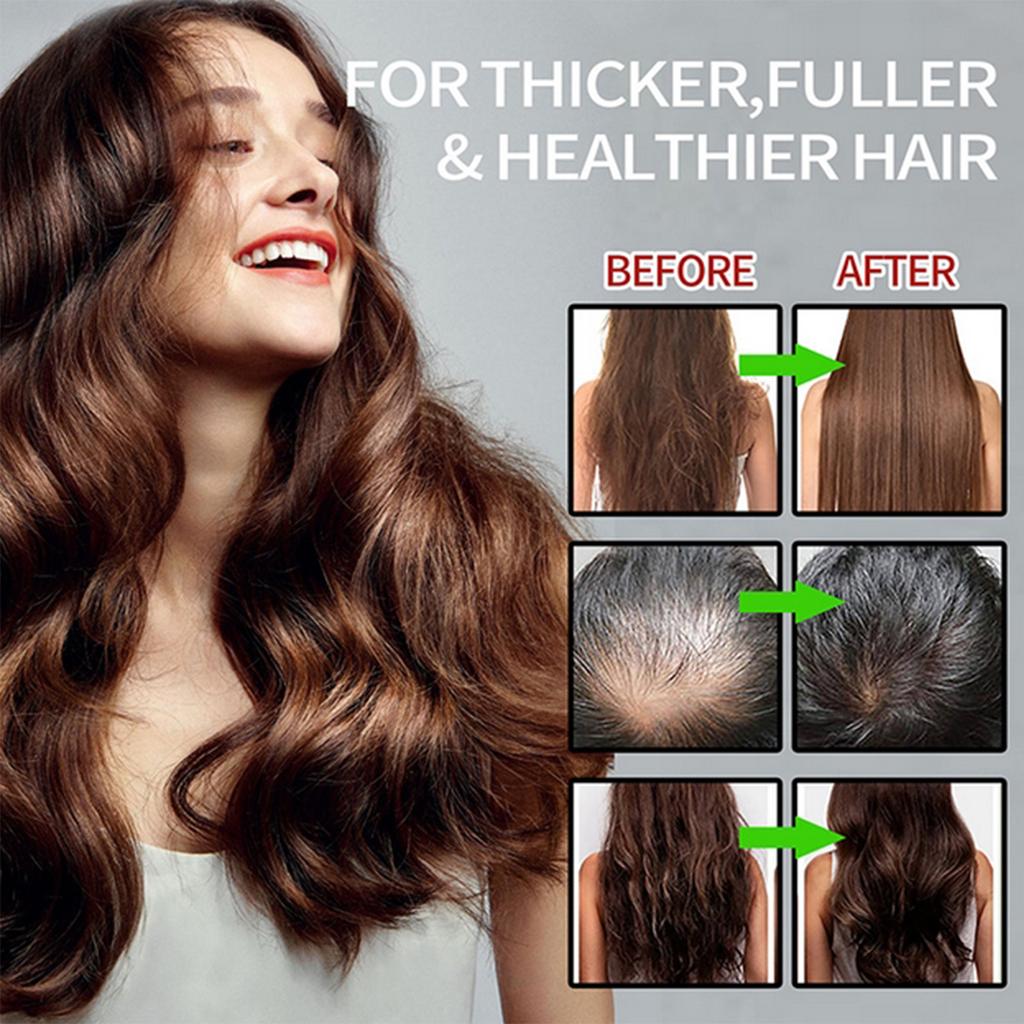 Natural Unrefined And Organic From Honduras For Hair Growth - Enhances Hair Thickness Loss For Men Women156.6ml