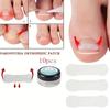 1box Nail Patch Nail Groove Inlay Corrector for Toenail Repair Quick Adhesive Strip