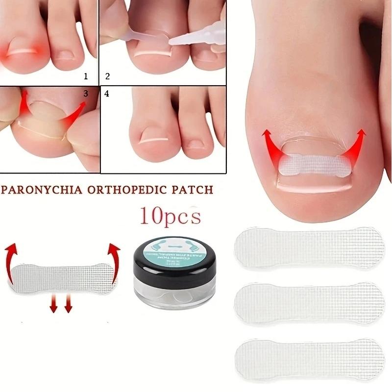 1box Nail Patch Nail Groove Inlay Corrector for Toenail Repair Quick Adhesive Strip