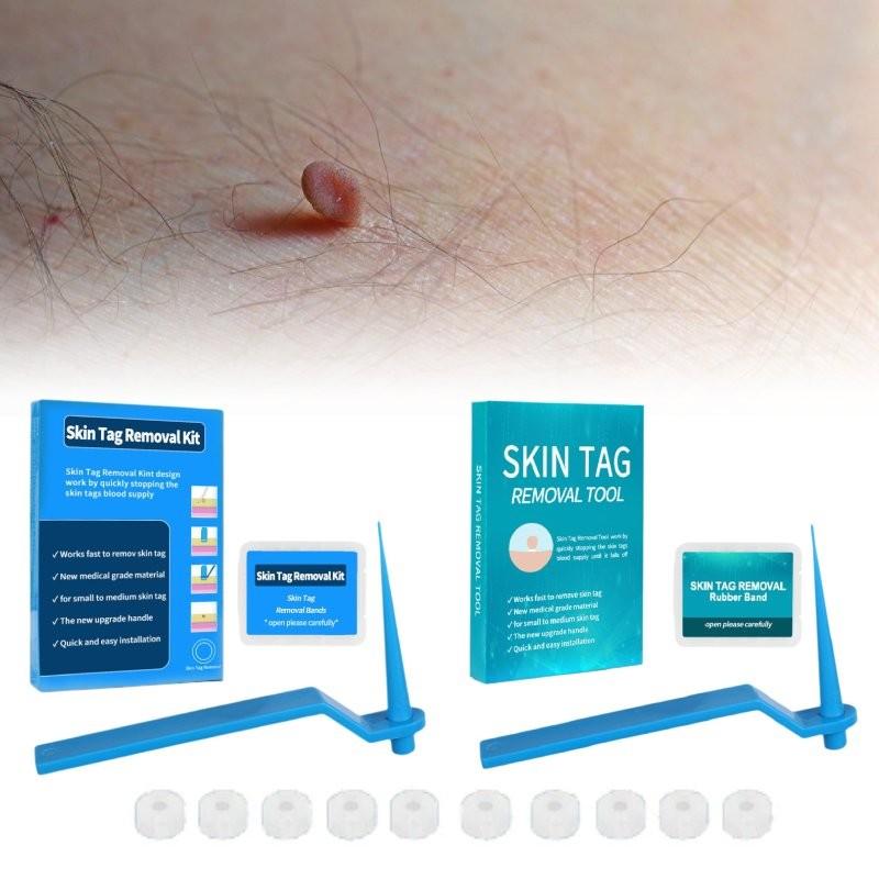 Effective Skin Tag Removal Tag Refill Band Set With 10 Pieces For Smooth Skin