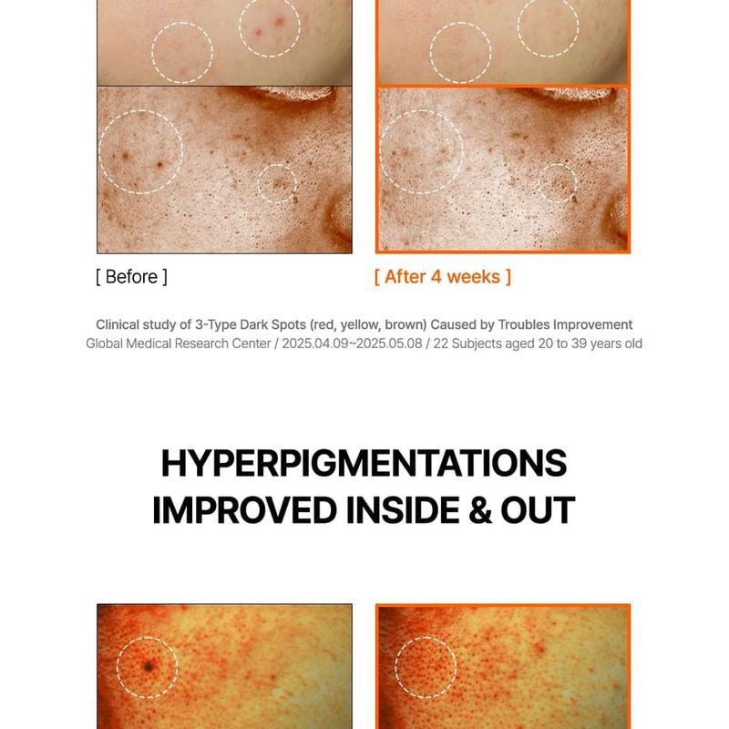 By Wishtrend Mandelic Acid Dark Spot Correcting Serum