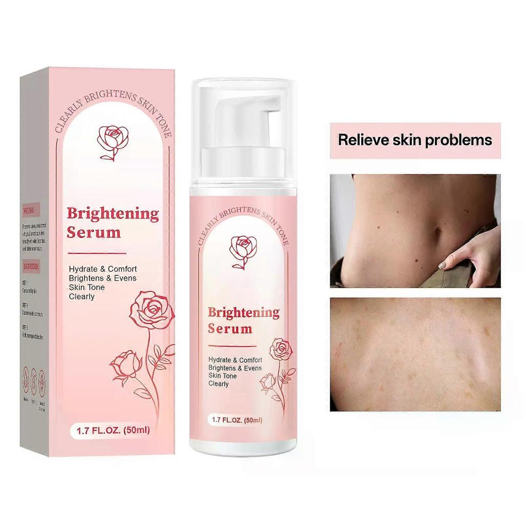 Dunkelfleckenentferner für Gesicht und Körper - Dunkelflecken-Korrekturserum für das Gesicht - Aufhellendes Serum - Braune Fleckenkorrektor gleicht den Hautton aus für alle Hauttypen