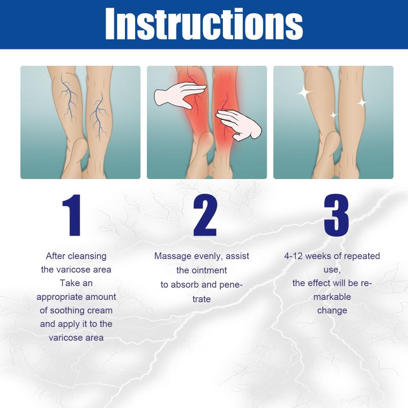 Treatment Creams Soothing Painness Eliminate Vasculitis Phlebitis Remove Spider Leg Angiitis Improvement Ointment