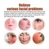 Soothing Repair Serum Redness Relief Hydrating Essence 30ml Face Care Sensitive Skin