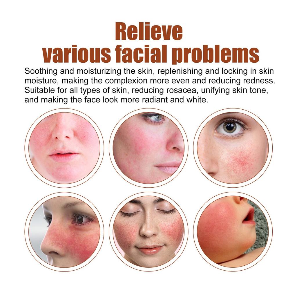 Soothing Repair Serum Redness Relief Hydrating Essence 30ml Face Care Sensitive Skin