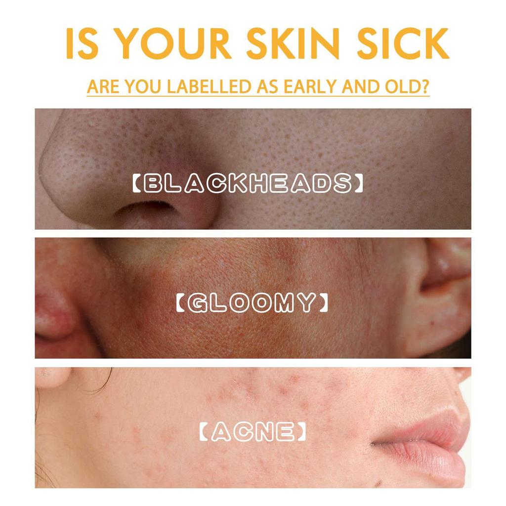 Brightening Peel-off Mask, Whitening And Beautifying Skin, Lightening Spots, Melanin, Removing Blackheads, Anti-wrinkle, Firming Skin