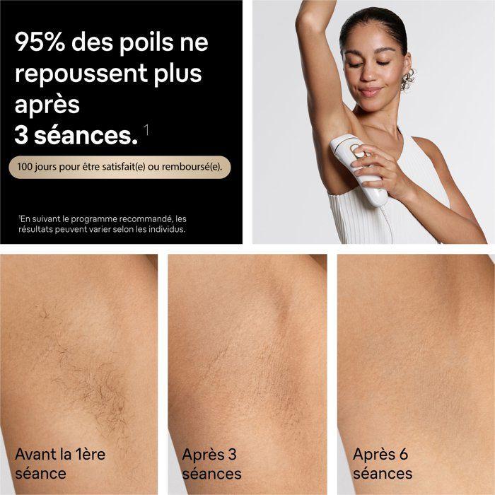 Pulsed Light Epilator - BRAUN - Silk Expert Pro 5 PL5221 - IPL - SkinProtect Sensor - White and Gold