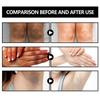 100 g stärkende Basho-Seife, Acanthosis Nigricans, stärkende Seife, Basho-Seife, Basho-Seife für helle Haut, dunkle Bereiche, für Gesicht/Hals/Achselhöhlen