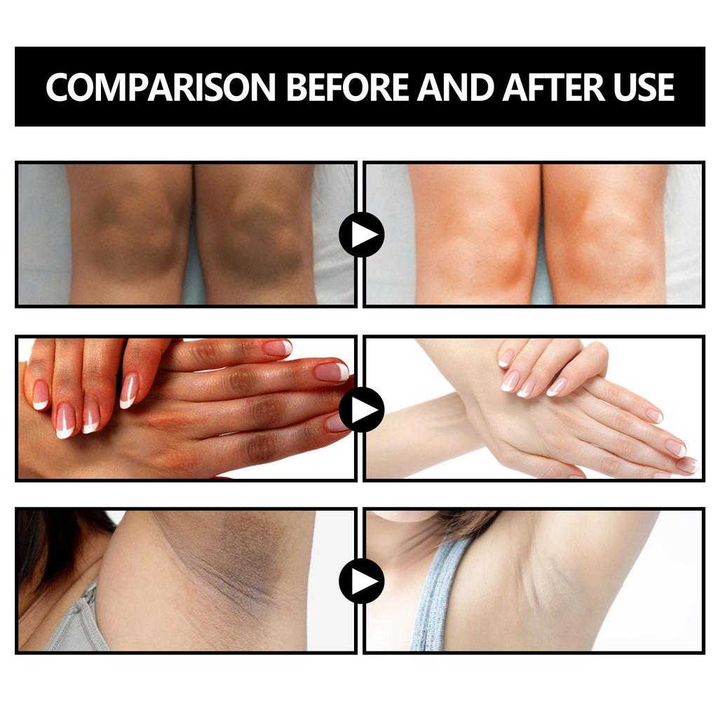100 g stärkende Basho-Seife, Acanthosis Nigricans, stärkende Seife, Basho-Seife, Basho-Seife für helle Haut, dunkle Bereiche, für Gesicht/Hals/Achselhöhlen