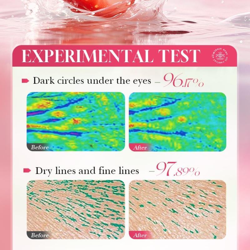 Strawberry Eye Cream 20g VC Moisturizing Hydrating Brightening Eye Moisturizing Eye Cream Skin Care Products