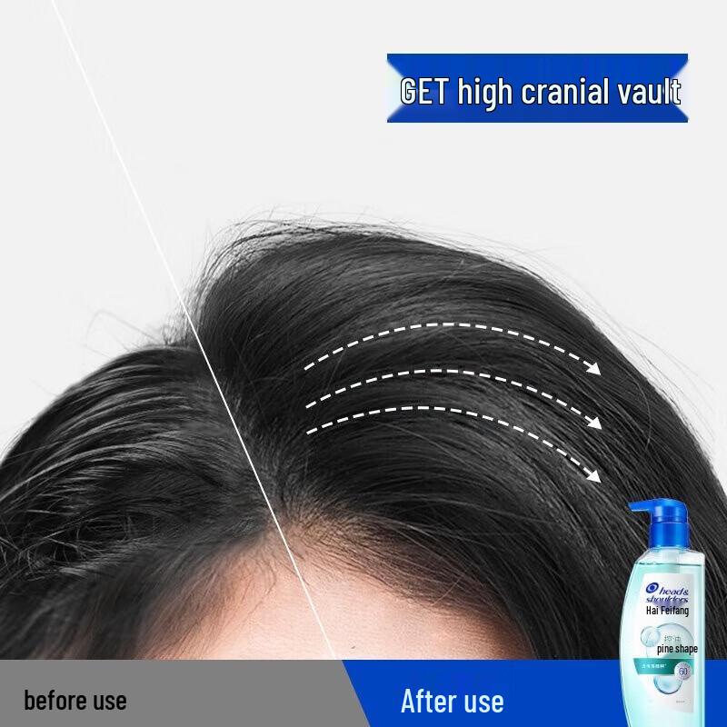 Head & Shoulders Anti-Dandruff Scalp Care Shampoo