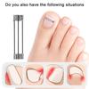 1 Set Professional Ingrown Toenail Corrector Clip Brace Pedicure Recovery Tool for Toe Nail Treatment Embed Straightening Tool