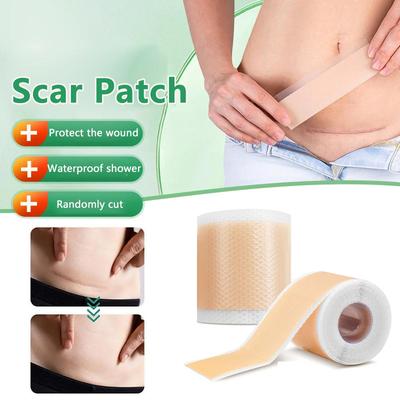 1 Roll Scar Sheets Non-slip 4X150CM Self Adhesive Skin Beauty Care Waterproof Scar Tape Silicone Gel Patch Skin Repair