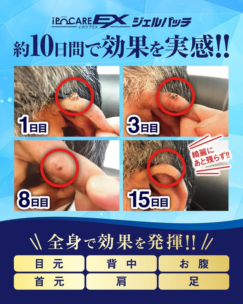 Ipocare EX Gel Patch 25g For and Gel Pack Exfoliating Care Contains Salicylic Acid and Tears Extract Made In Japan Spot Care Brain Cosmos Neck, Face,