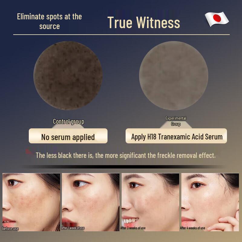 H18 Tranexamic Acid Spot Correcting Essence