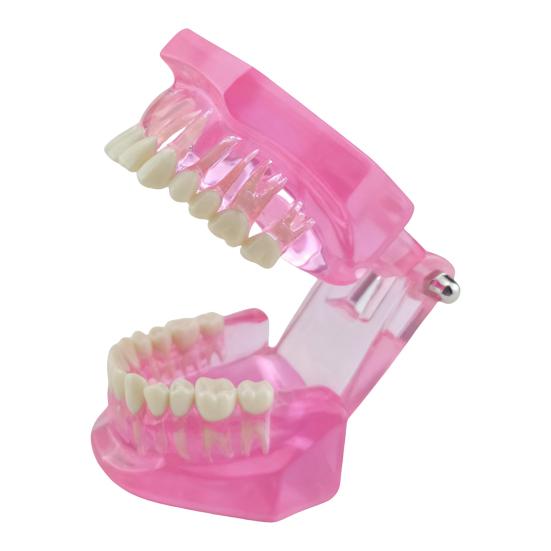 Dental Implant Model Teaching Aid for Dentist Student School Removable Teeth