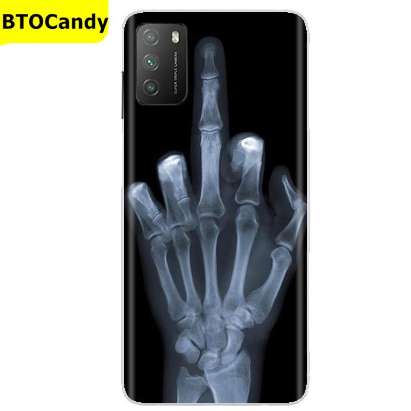 Für POCO M3 Hülle, Weiche Silikon-Rückseite, Telefonhülle für Xiaomi Poco M3 Pro 5G, Rückseitige Abdeckung, Weiche TPU Coque für POCO M 3 M3 Silikonhülle